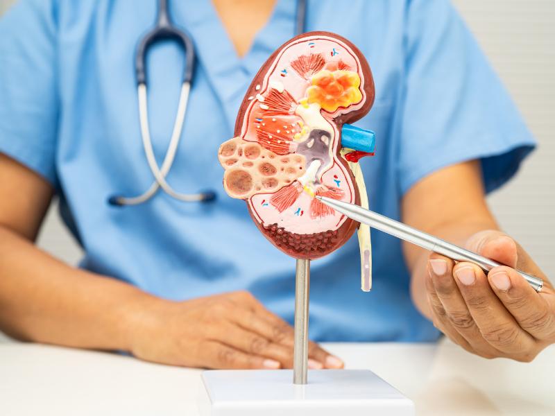 Hérnias Urológicas